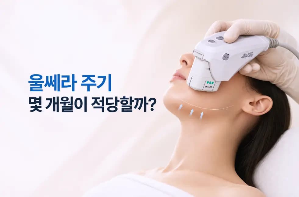 턱선 리프팅을 위한 정품 울쎄라 트랜스듀서 밀착과 권장 시술 주기 기준을 소개하는 대표 썸네일