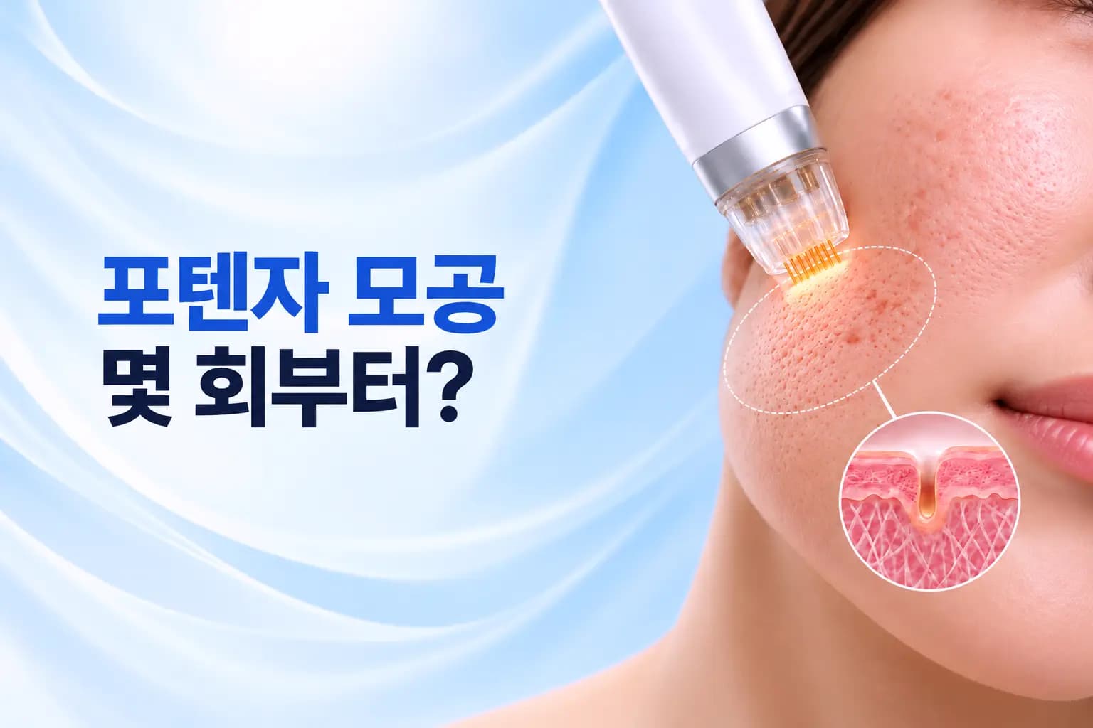 미세니들 고주파 핸드피스가 모공 피부에 닿으며 진피 콜라겐이 차오르는 회차별 변화를 담은 포텐자 모공 썸네일